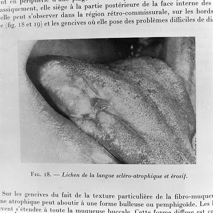 minerva_1972_c4_c4r3_002