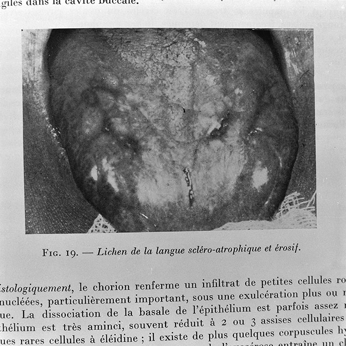 minerva_1972_c4_c4r3_003