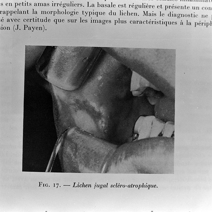 minerva_1972_c4_c4r3_006