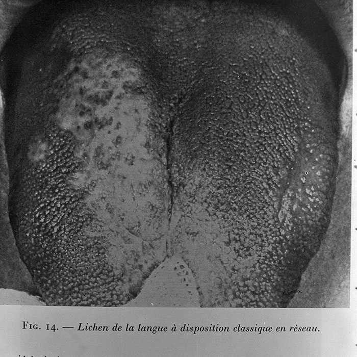 minerva_1972_c4_c4r3_007