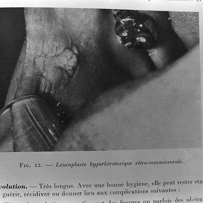 minerva_1972_c4_c4r3_009