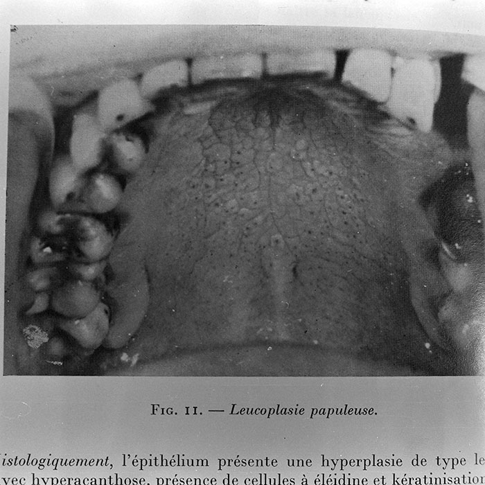 minerva_1972_c4_c4r3_010