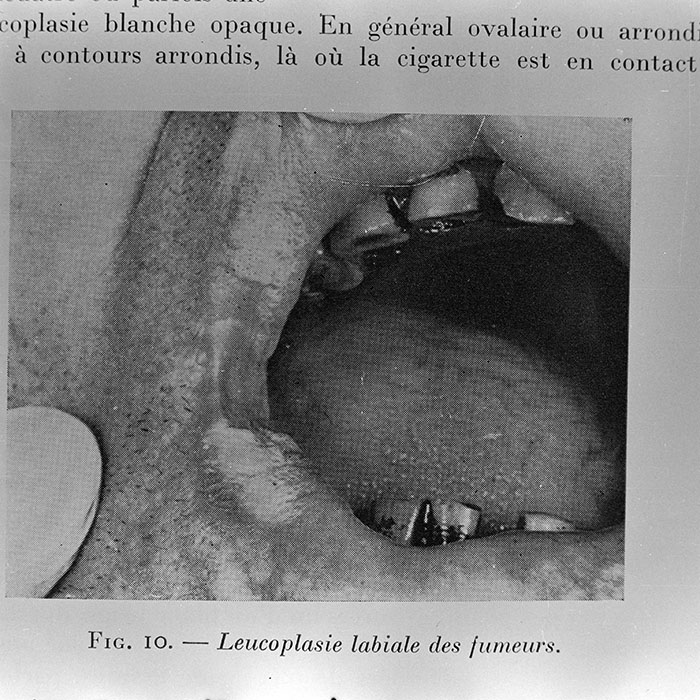 minerva_1972_c4_c4r3_012